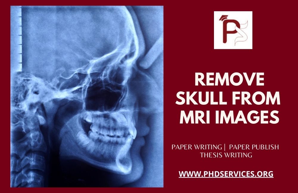 Remove Skull from MRI Images Research Guidance
